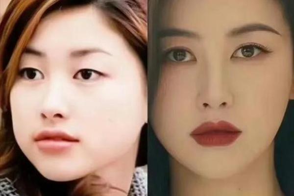 眼周痣，让你散发独特气质的秘密