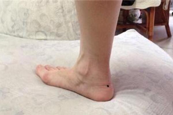 脚跟有痣的人运势如何？揭秘痣相中的财运奥秘