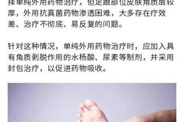 探秘脚后跟露外面对你命运的深远影响