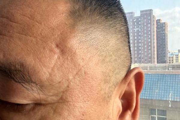 额头皱纹揭示命运：揭秘额头纹路的秘密与人生轨迹